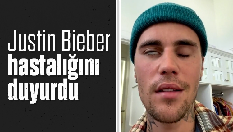 Justin Bieber, yüz felcine yakalandı