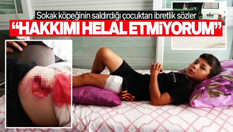Antalya'da sokak köpeği 11 yaşındaki Hasan'a saldırdı: Baldırından et koparıldı