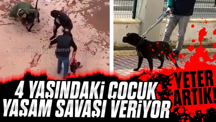 Son köpek terörü Gaziantep'te: 4 yaşındaki kız çocuğu yaşam savaşı veriyor